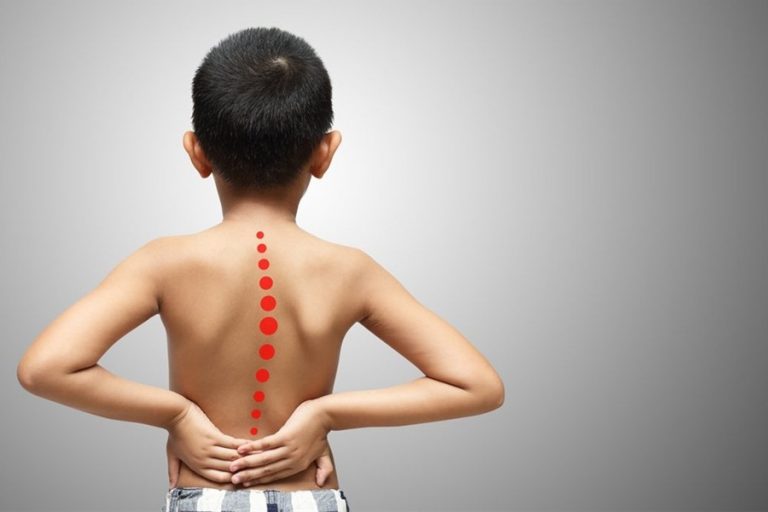 Backpain in Kids – Causes & When to Worry – Dr Yash Shah